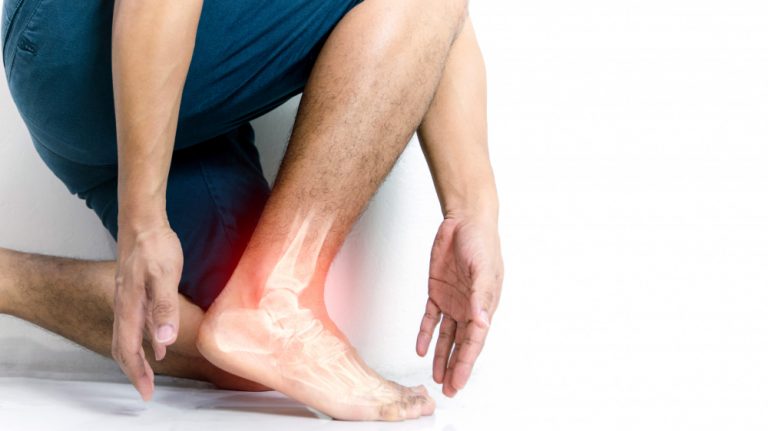 inflammation bone ankle humans with inflammation